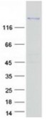 SDS-PAGE (PNPLA6-920HFL).jpg